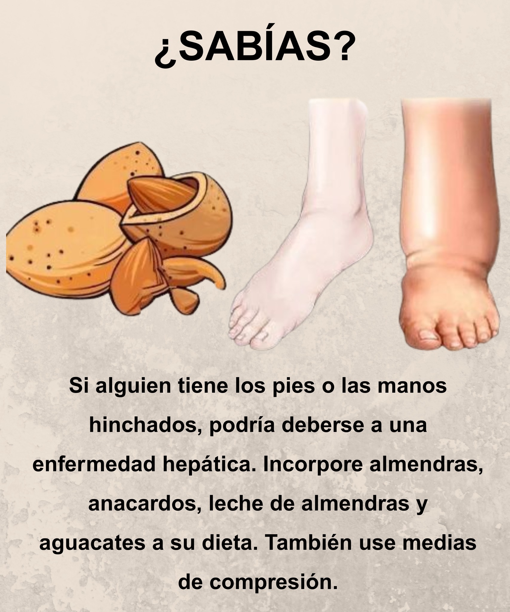 Hinchazón en pies o manos: una señal que podría alertar sobre tu salud hepática