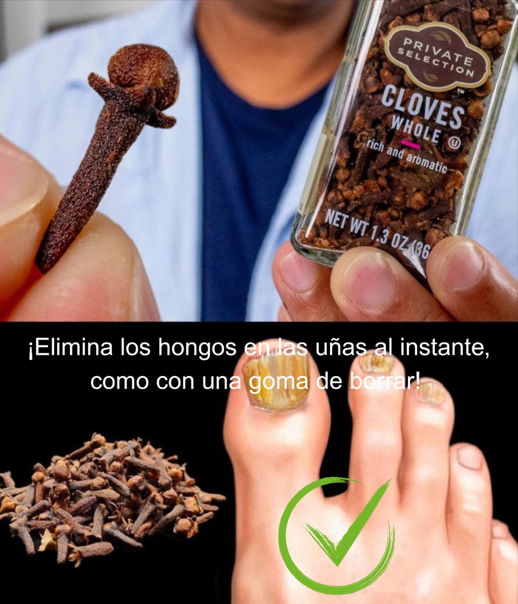 Elimina los hongos en las uñas de forma natural y efectiva